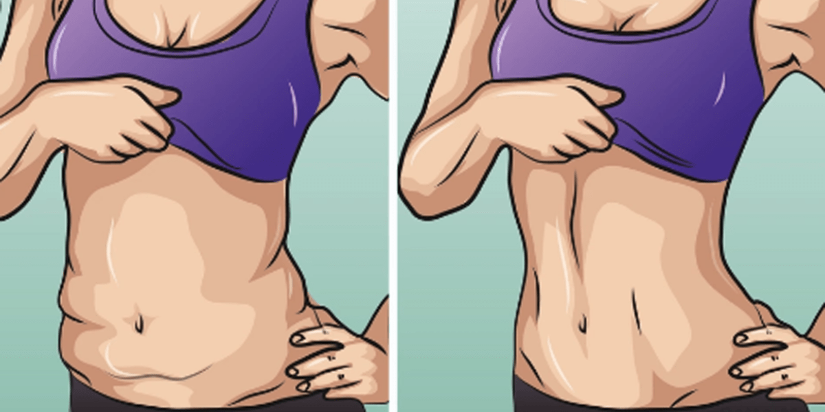 Loose Skin After Weight Loss